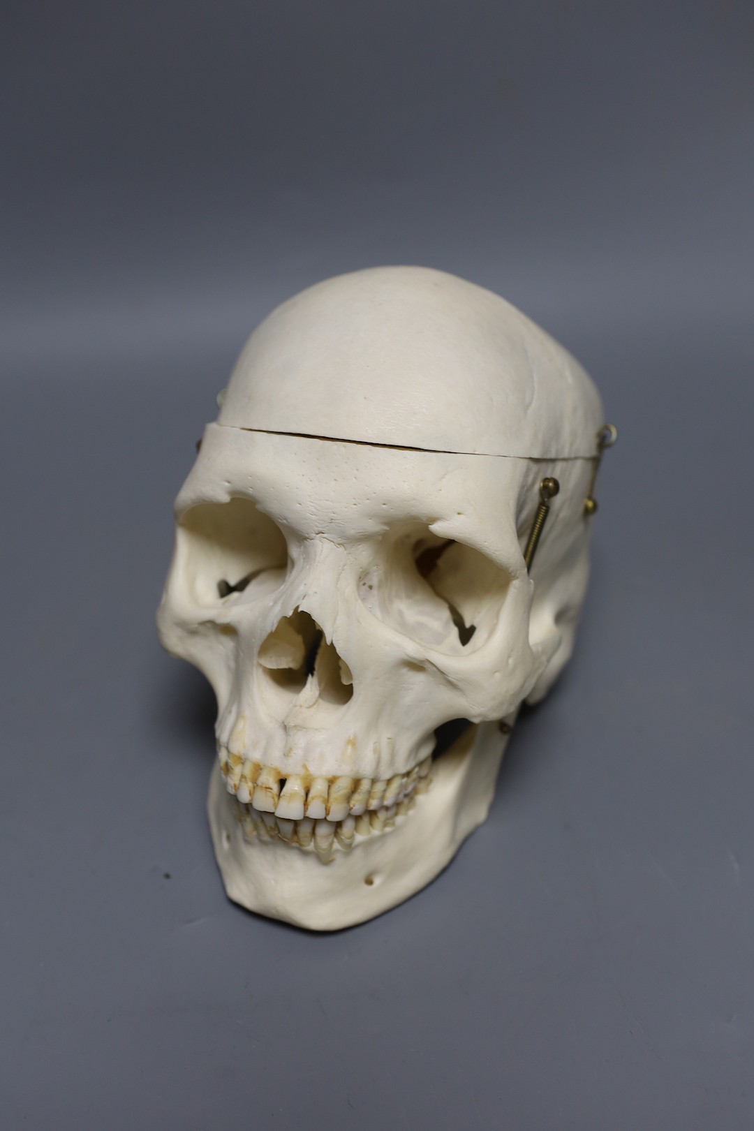 A human male skull, the vendor bought the item prior to 1977